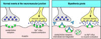Figure 13.10. Autoantibodies inhibit receptor function in myasthenia gravis.