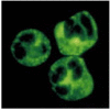 Figure 13.14. Serum from patients with Wegener's granulomatosis contains autoantibodies reactive with neutrophil cytoplasmic granules.