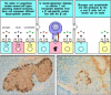 Figure 13.21. Selective destruction of pancreatic β cells in insulin-dependent diabetes mellitus (IDDM) indicates that the autoantigen is produced in β cells and recognized on their surface.
